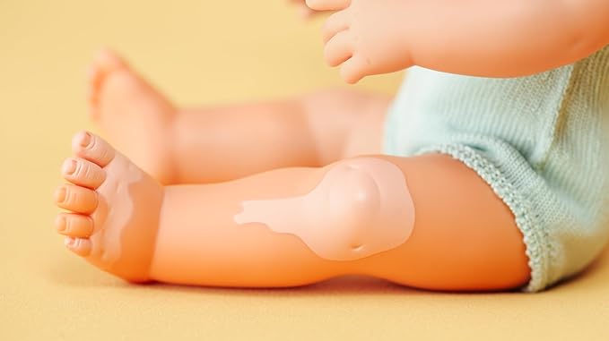 Miniland Doll 15'' Caucasian Girl with Vitiligo (Polybag) - Made in Spain, Anatomically Correct, Inclusion, Quality Toy