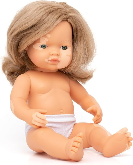 Miniland Doll 15'' Caucasian Girl with Vitiligo (Polybag) - Made in Spain, Anatomically Correct, Inclusion, Quality Toy